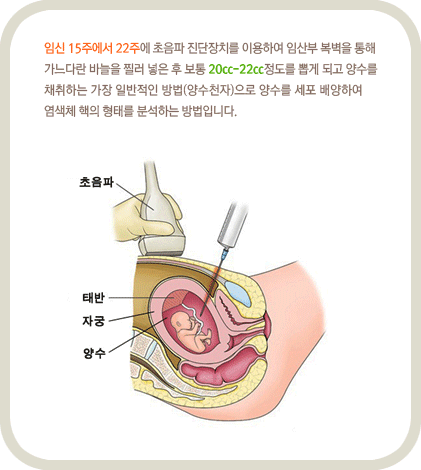 ÀӽŠ15ÁÖ¿¡¼ 22ÁÖ¿¡ ÃÊÀ½ÆÄ Áø´ÜÀåÄ¡¸¦ ÀÌ¿ëÇÏ¿© ÀÓ»êºÎ º¹º®À» ÅëÇØ °¡´À´Ù¶õ ¹Ù´ÃÀ» Âñ·¯ ³ÖÀº ÈÄ º¸Åë 20cc-22ccÁ¤µµ¸¦ »Ì°Ô µÇ°í ¾ç¼ö¸¦ äÃëÇÏ´Â °¡Àå ÀϹÝÀûÀÎ ¹æ¹ý(¾ç¼öõÀÚ)À¸·Î ¾ç¼ö¸¦ ¼¼Æ÷ ¹è¾çÇÏ¿© ¿°»öü ÇÙÀÇ ÇüŸ¦ ºÐ¼®ÇÏ´Â ¹æ¹ýÀÔ´Ï´Ù.
